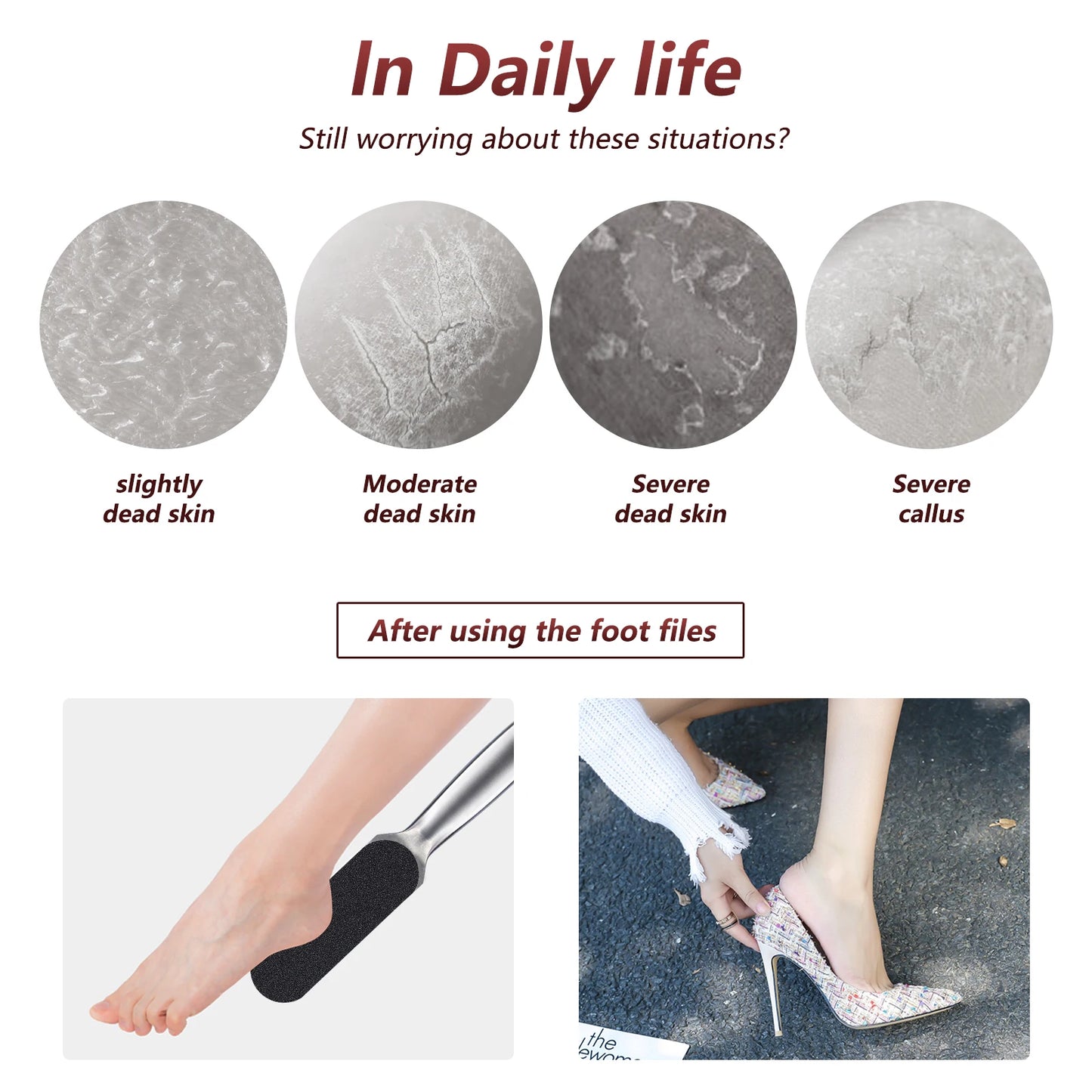 Foot Rasp Profession Feet Care