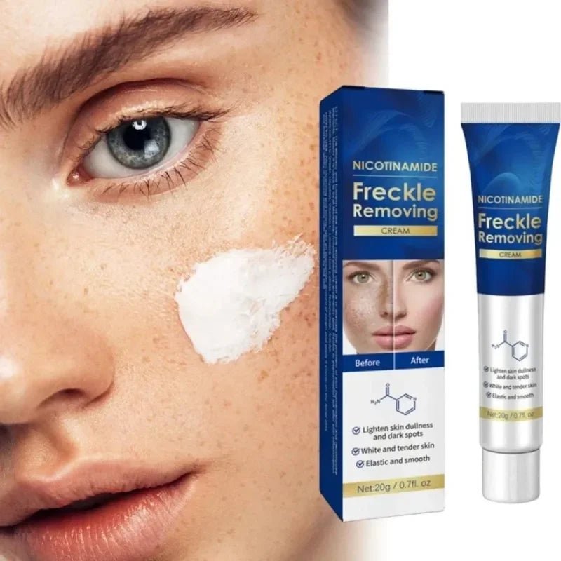 FarmStay Nicotinamide Freckle Removing Cream - LuckyShop - FarmStay