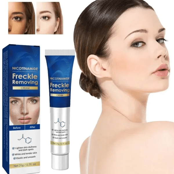 FarmStay Nicotinamide Freckle Removing Cream - LuckyShop - FarmStay